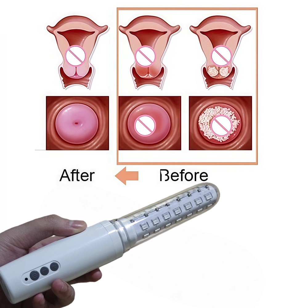 650nm LLLT Cold Laser Wand, Wo – Health Wellness Home Care Bewertung und Preis